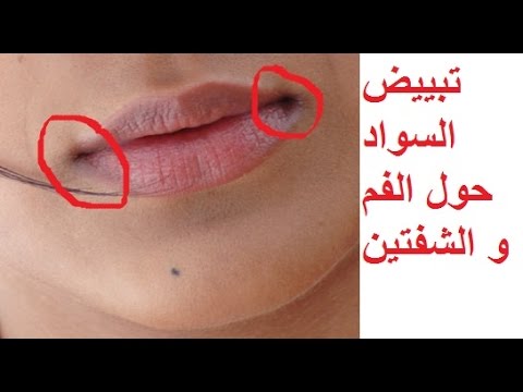 شاهد وصفة لعلاج السواد حول الفم