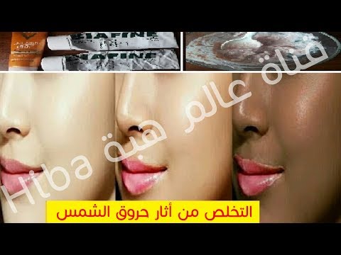 شاهد تبييض فوري للبشرة بعد التعرض لأشعة الشمس الحارقة في فصل الصيف