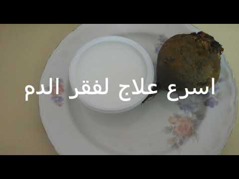 بالفيديو علاج الأنيميا في 3 أيام