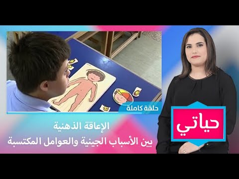 شاهدأخصائيون يكشفون أسباب الإعاقة الذهنية لدى الأطفال وطرق التعامل معها