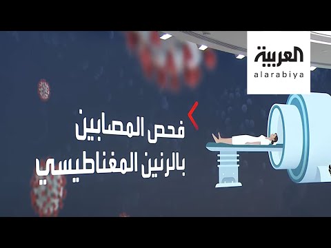 دراسة تكشف حقائق جديدة حول تأثيرات خطيرة لـكورونا على الجسم