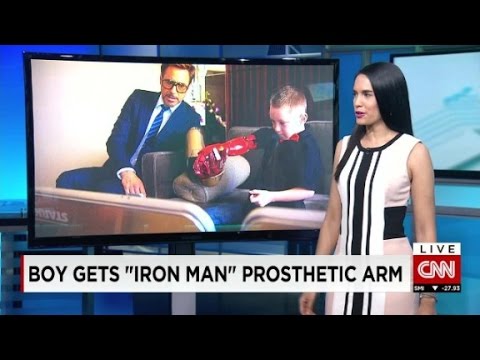 group gives superhero prosthetic limbs to children